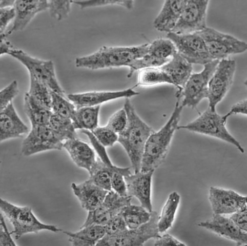 BT.549 Cells#人乳腺导管癌细胞系活性强|培养基|送STR图谱