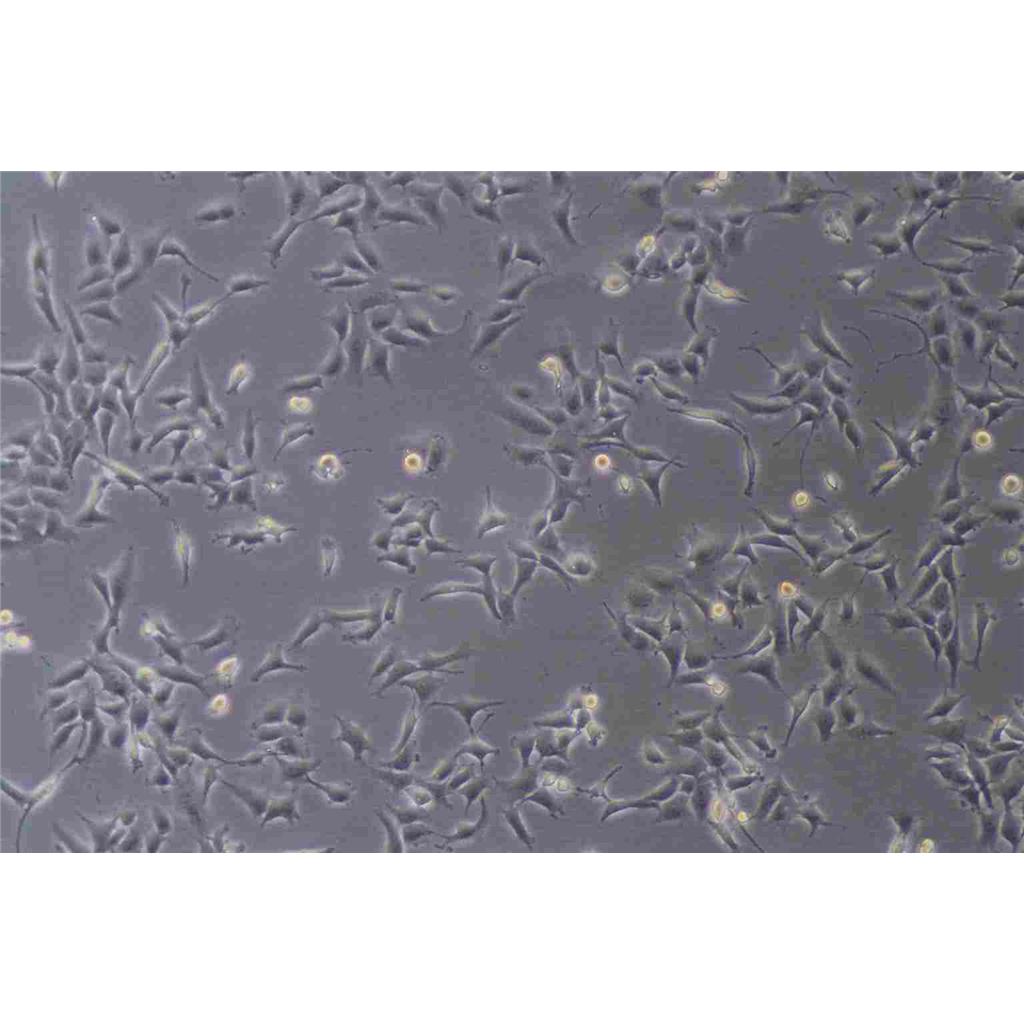 Eca-109 Cells#人食管癌细胞系活性强|培养基|送STR图谱