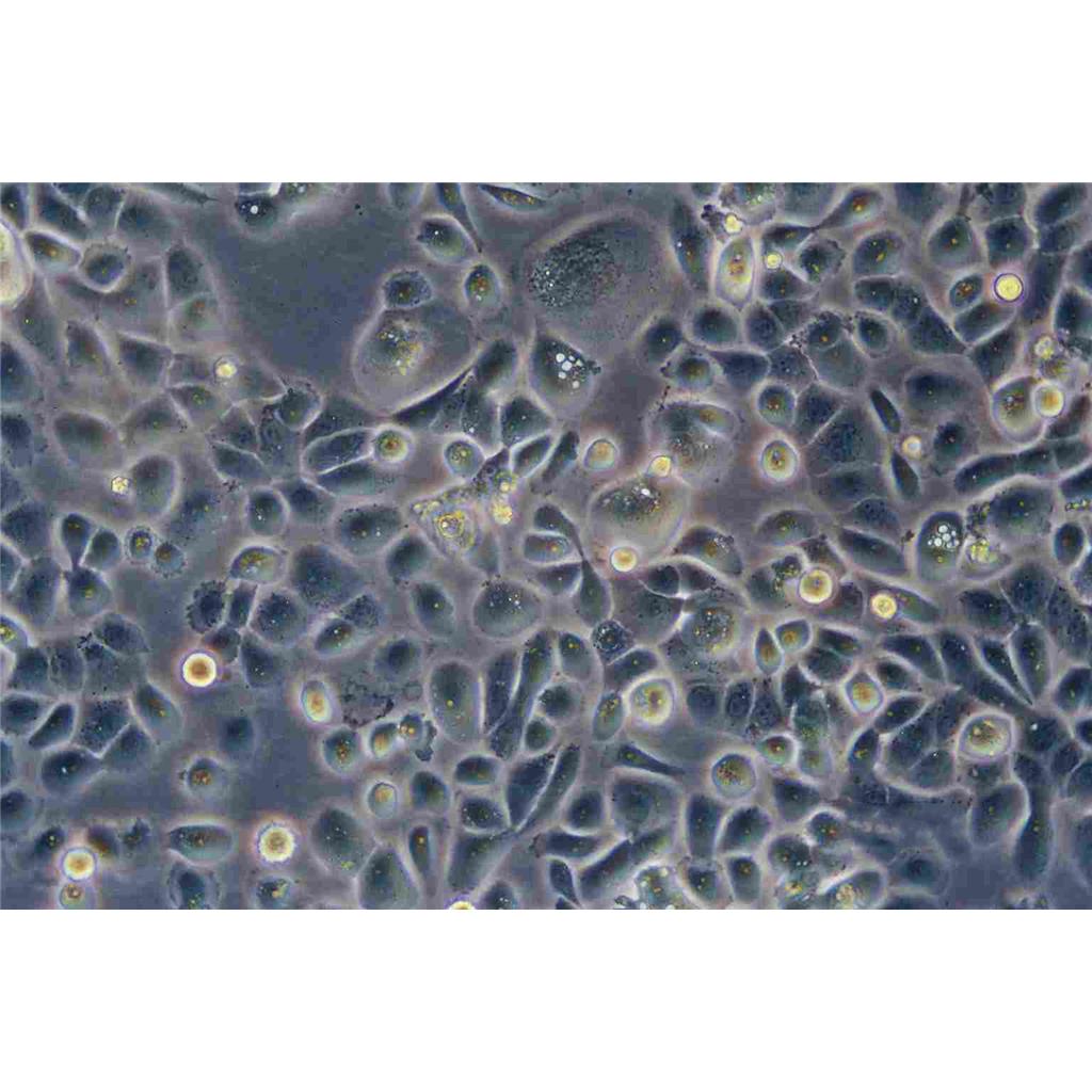 Hepa 1-6 Cells#小鼠肝癌细胞系活性强|培养基|送STR图谱