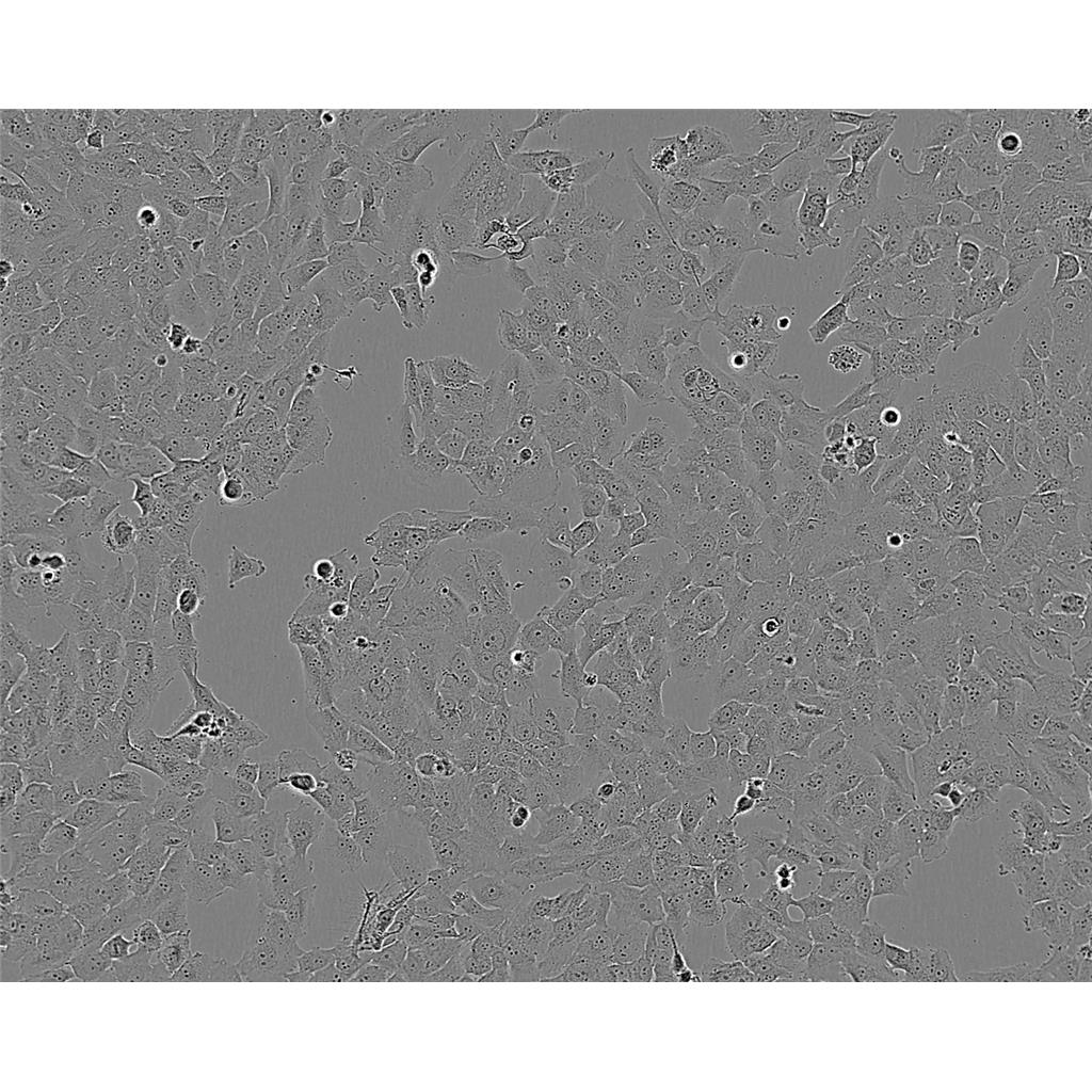 NCI-H1792 Cells#人肺腺癌细胞系低代次|培养基|赠STR图谱