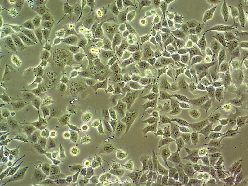 MeWo Cells#人恶性黑色素瘤细胞系低代次|培养基|赠STR图谱