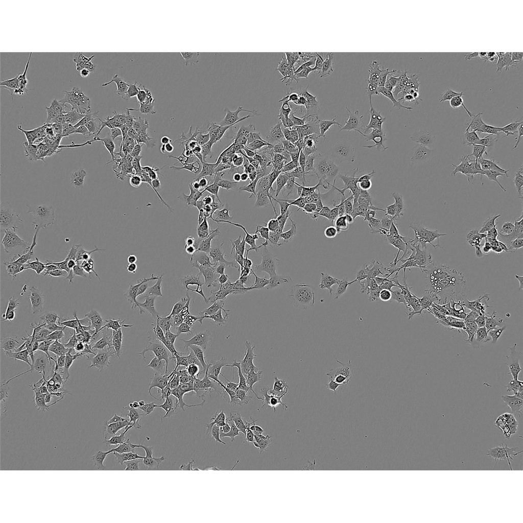 OVCAR-8 Cells#人卵巢癌细胞系低代次|培养基|赠STR图谱