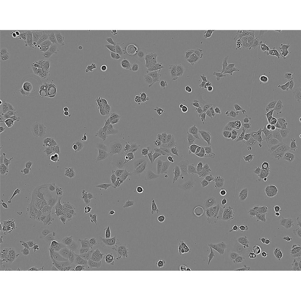 TE-12 Cells#人食管癌细胞系低代次|培养基|赠STR图谱