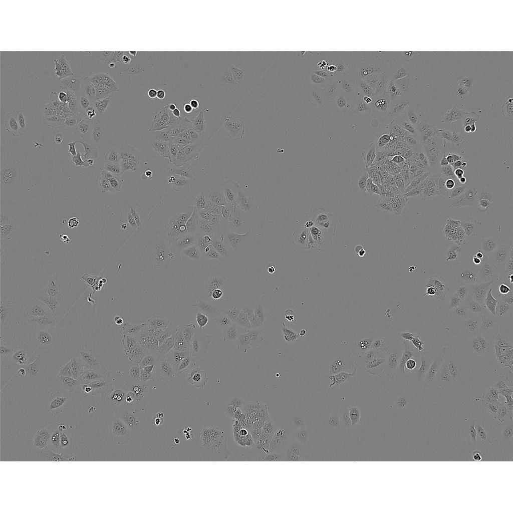 RT-112 Cells#人膀胱癌细胞系低代次|培养基|赠STR图谱