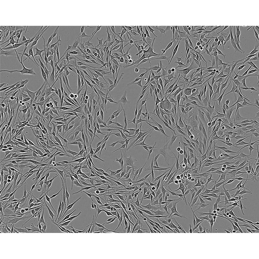 NCI-H69 Cells#人小细胞肺癌细胞系低代次|培养基|赠STR图谱