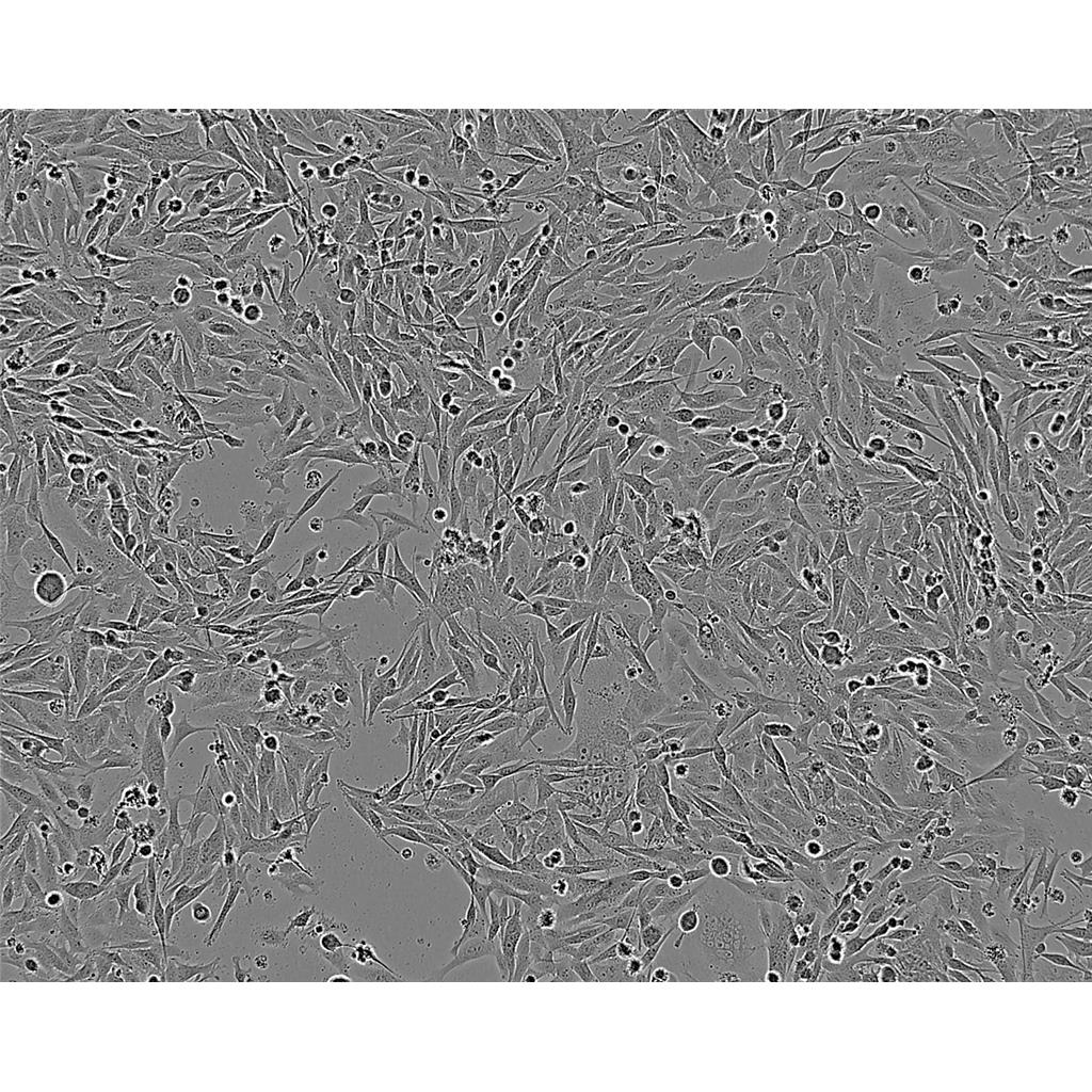 KYSE-410 Cells#人食管鳞癌细胞系低代次|培养基|赠STR图谱