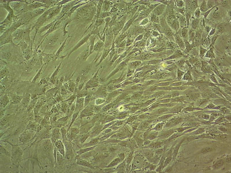 SK-CO-1 Cells#人结直肠腺癌细胞系低代次|培养基|赠STR图谱