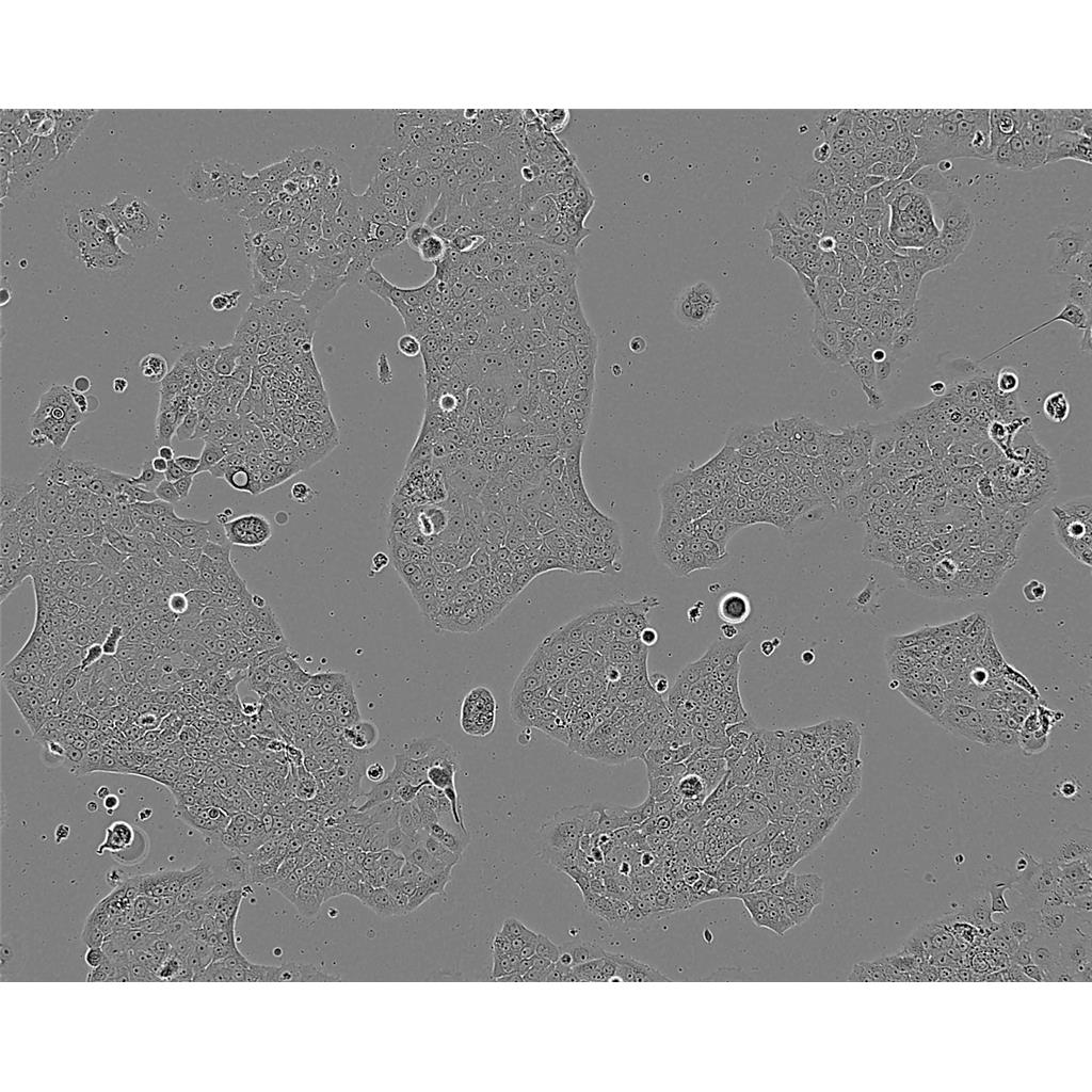 NCI-H2170 Cells#人肺鳞癌细胞系低代次|培养基|赠STR图谱