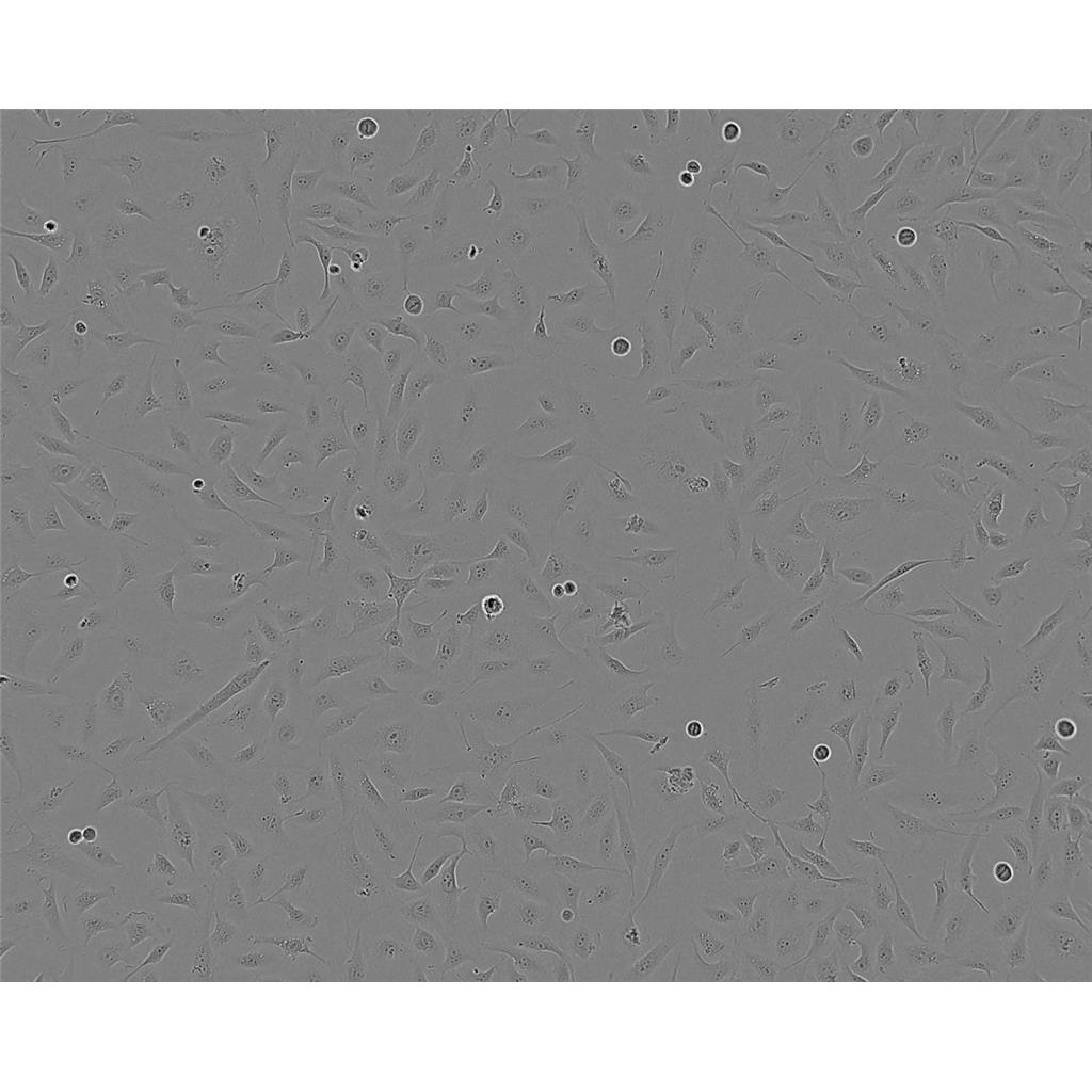 SK-OV-3 Cells#人卵巢癌细胞系低代次|培养基|赠STR图谱