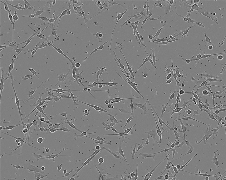 S3-HeLa Cells#人宫颈癌细胞系来源可靠|培养基|带STR基因图谱