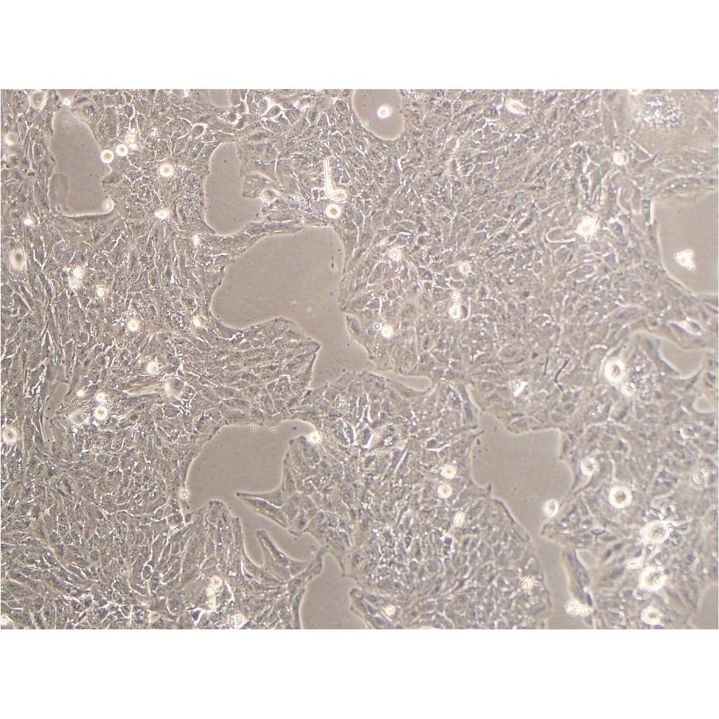 LS-174 Cells#人结直肠腺癌细胞系来源可靠|培养基|带STR基因图谱