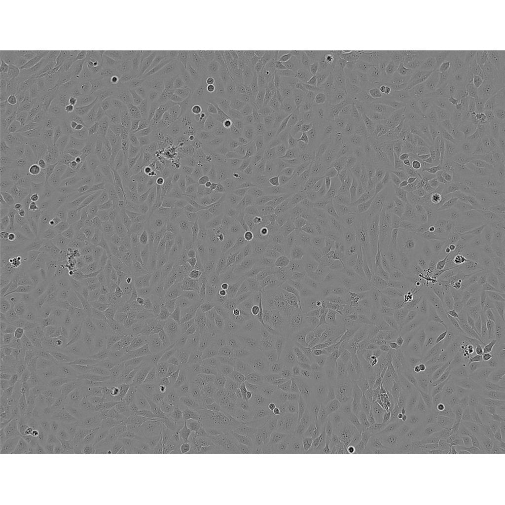 CA-OV-3 Cells#人卵巢癌细胞系来源可靠|培养基|带STR基因图谱