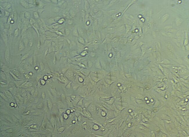 CFPAC Cells#人胰腺导管癌细胞系来源可靠|培养基|带STR基因图谱