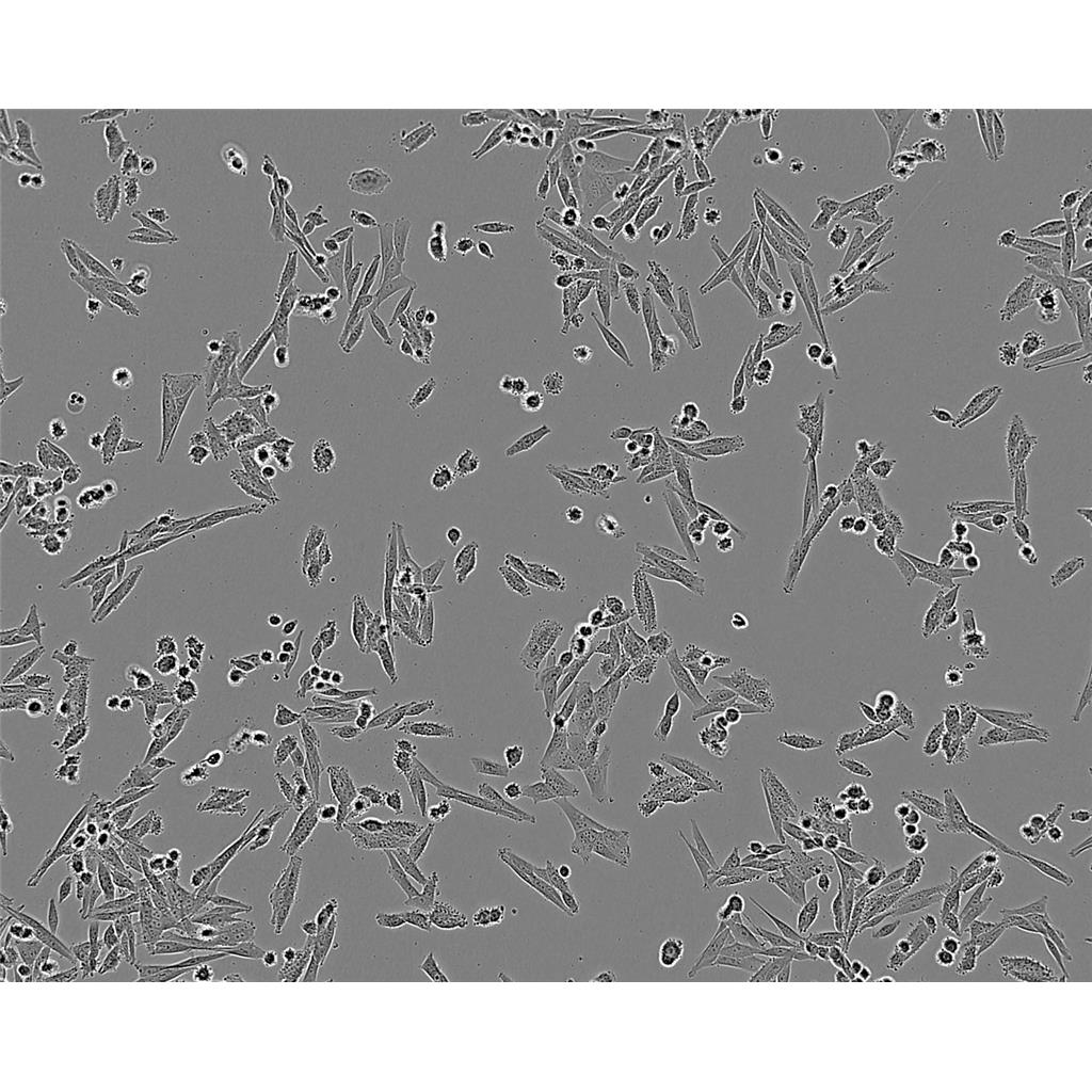 SKHEP-1 Cells#人肝癌细胞系来源可靠|培养基|带STR基因图谱