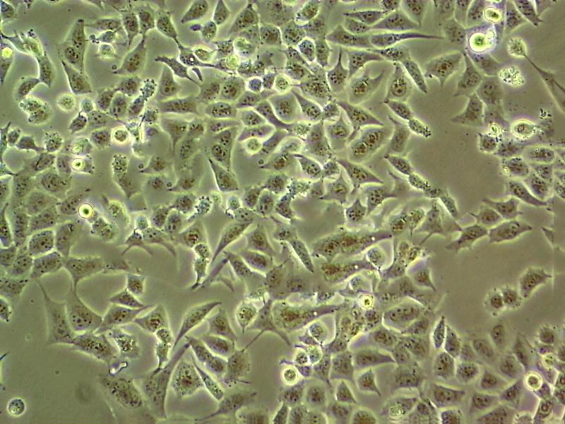 mda453 Cells#人乳腺癌细胞系来源可靠|培养基|带STR基因图谱