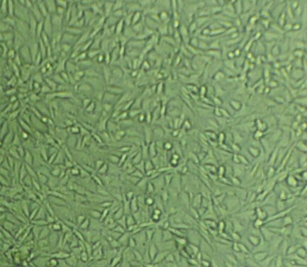 MB468 Cells#人乳腺癌细胞系来源可靠|培养基|带STR基因图谱