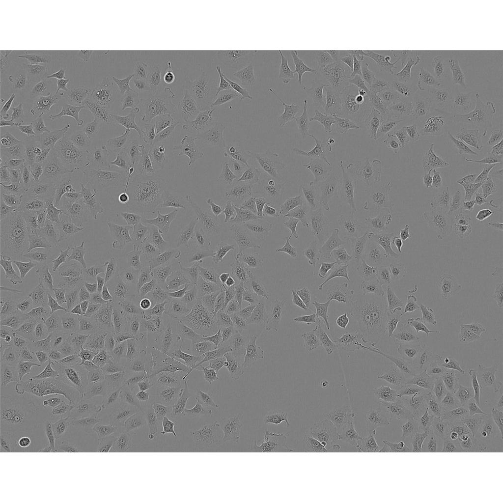 HPAF/CD18 Cells#人胰腺癌细胞系来源可靠|培养基|带STR基因图谱
