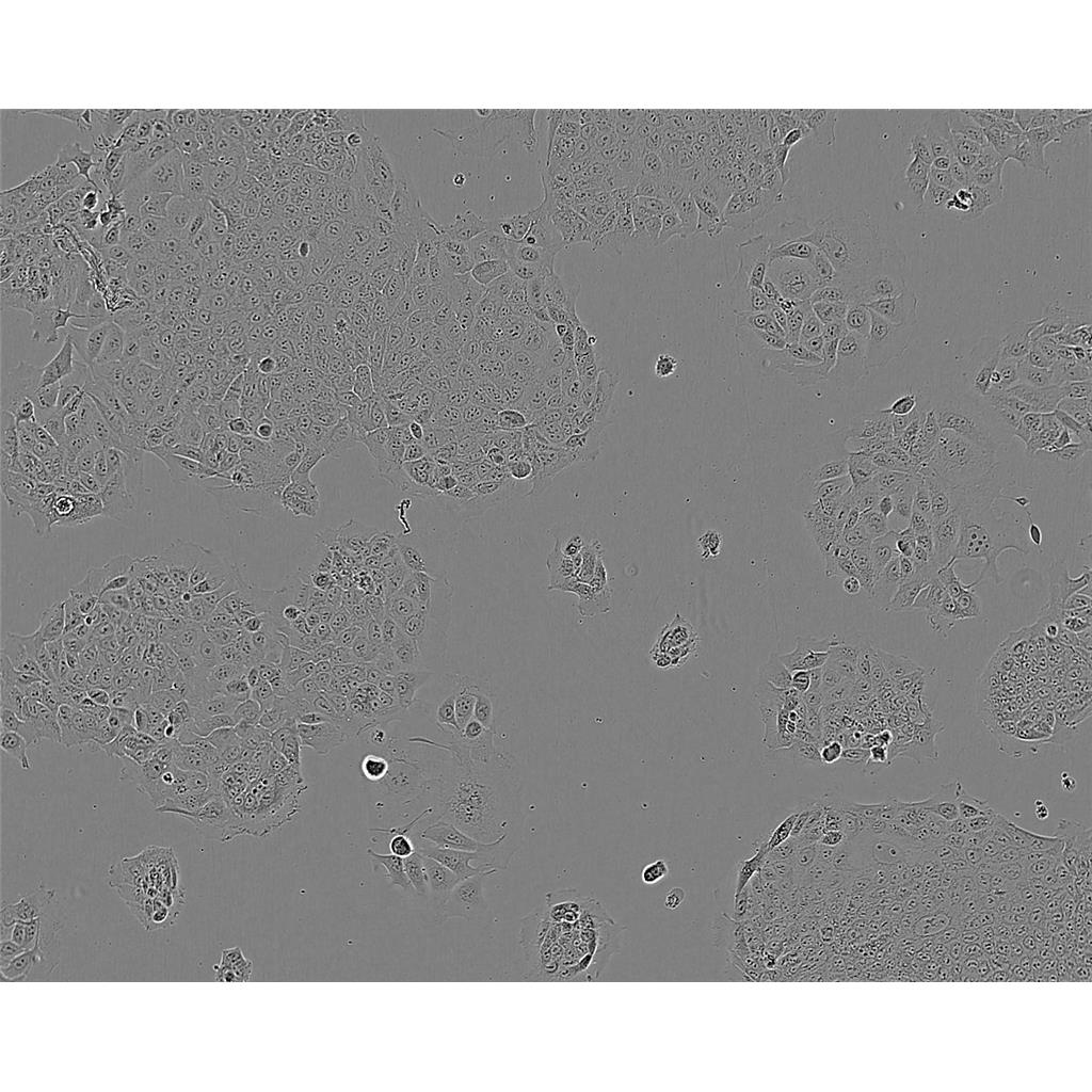 SKBR-3 Cells#人乳腺腺癌细胞系来源可靠|培养基|带STR基因图谱