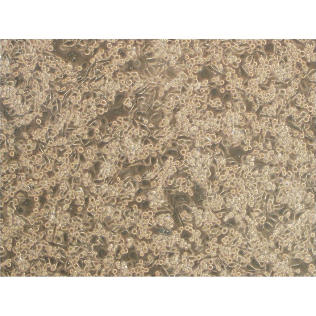 SKOV3 Cells#人卵巢癌细胞系来源可靠|培养基|带STR基因图谱