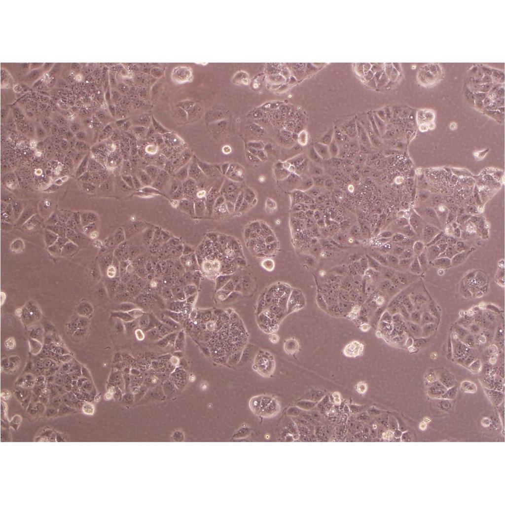 NCIH526 Cells#人肺癌细胞系来源可靠|培养基|带STR基因图谱