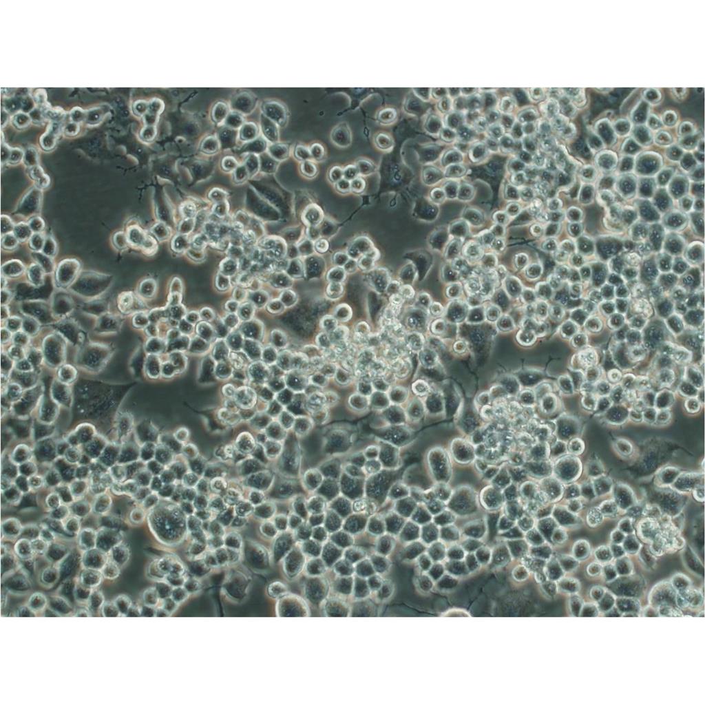 HEC1-A Cells#人子宫内膜癌细胞系来源可靠|培养基|带STR基因图谱