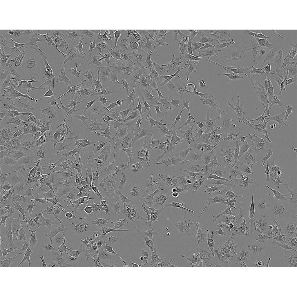 mdamB468 Cells#人乳腺癌细胞系来源可靠|培养基|带STR基因图谱