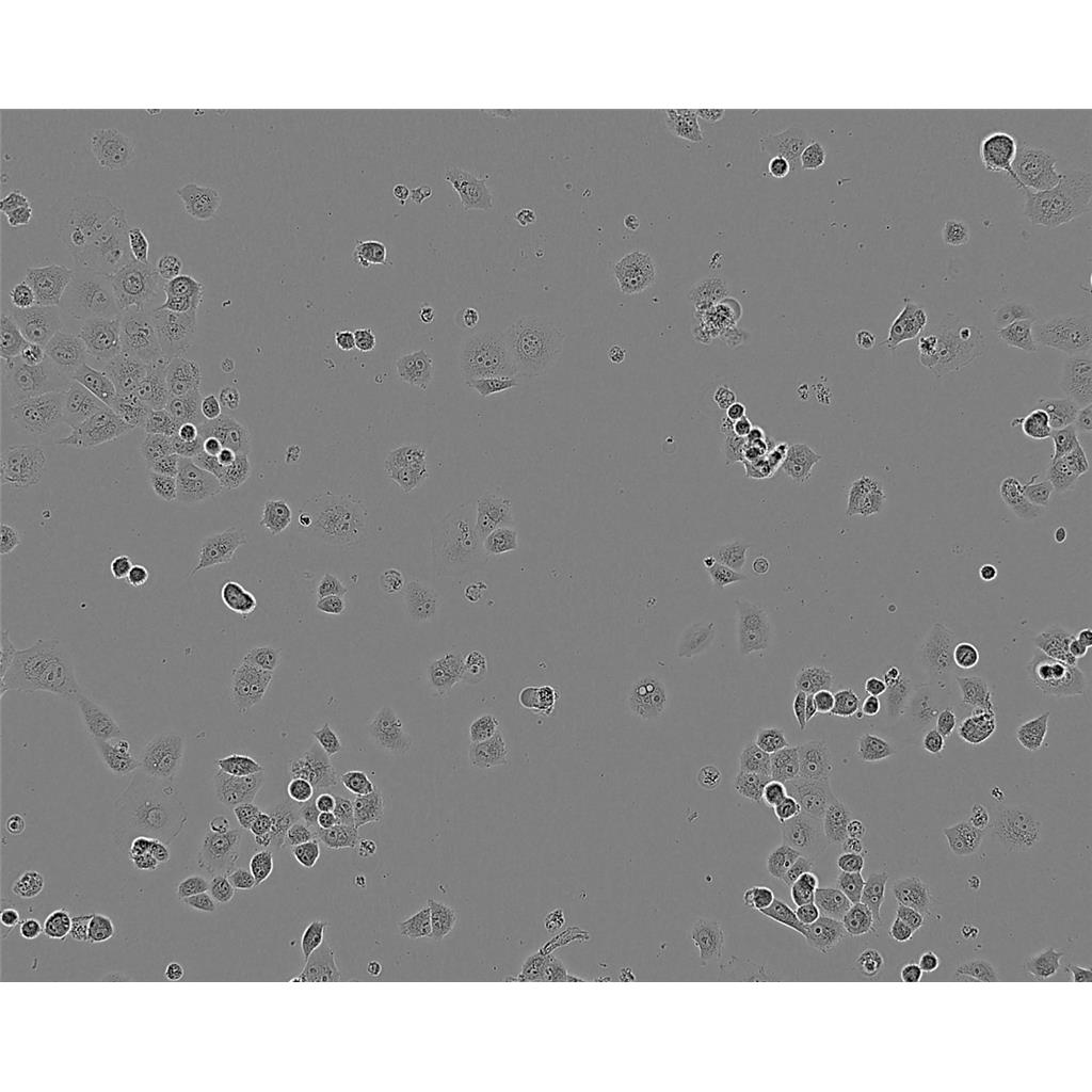 HCC 94 Cells#人子宫鳞癌细胞系来源可靠|培养基|带STR基因图谱