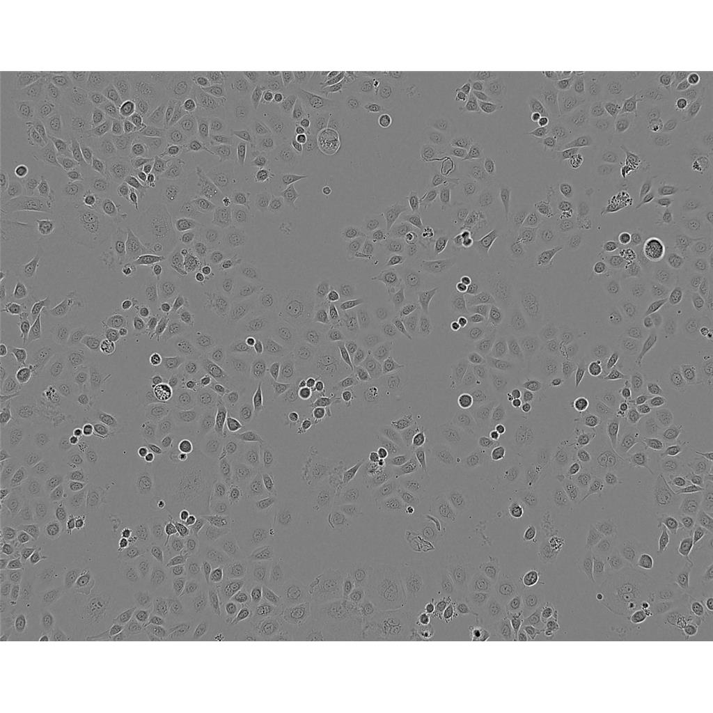 U-2OS Cells#人骨肉瘤细胞系来源可靠|培养基|带STR基因图谱