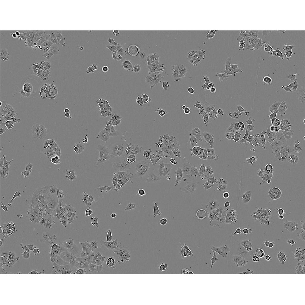 Kato-III Cells#人胃癌细胞系来源可靠|培养基|带STR基因图谱