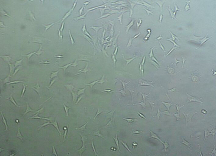 SW 948 Cells#人结肠腺癌细胞系来源可靠|培养基|带STR基因图谱