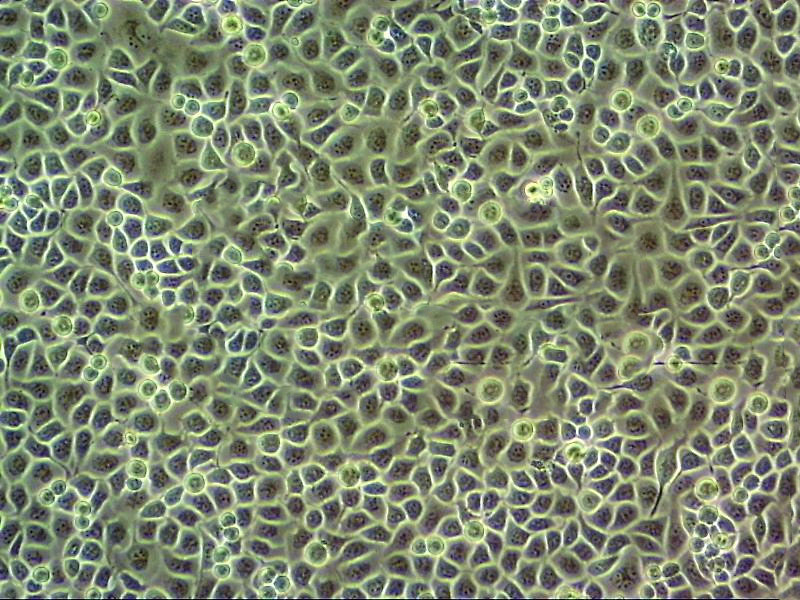 mda MB 453 Cells#人乳腺癌细胞系来源可靠|培养基|带STR基因图谱