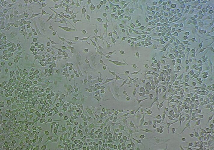 MDBK (NBL-1) Cells#牛肾细胞系来源可靠|培养基|带STR基因图谱