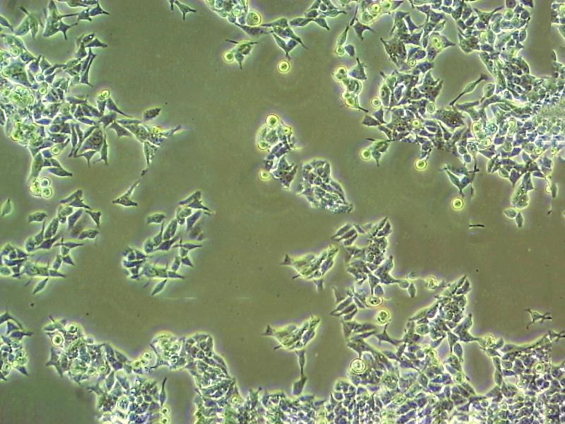 PA1 Cells#人卵巢畸胎瘤细胞系来源可靠|培养基|带STR基因图谱