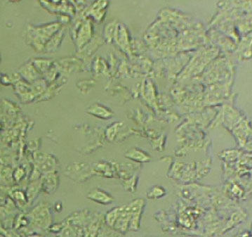 SW-579 Cells#人甲状腺鳞癌细胞系来源可靠|培养基|带STR基因图谱