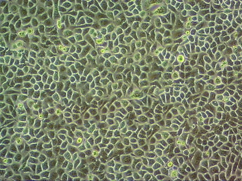 HCC-827 Cells#人非小细胞肺癌细胞系来源可靠|培养基|带STR基因图谱