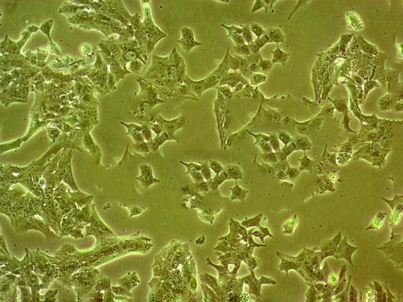 NCI-H446 Cells#人小细胞肺癌细胞系来源可靠|培养基|带STR基因图谱