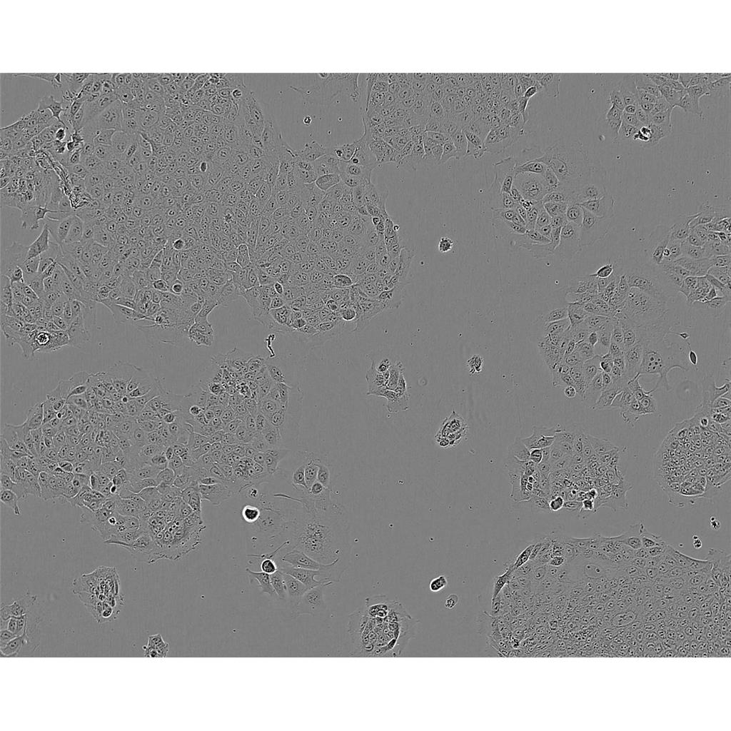 SK-N-DZ Cells#人神经母细胞瘤细胞系来源可靠|培养基|带STR基因图谱