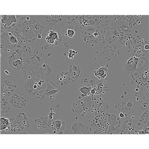 MCF7 Cells#人乳腺癌细胞系来源可靠|培养基|带STR基因图谱