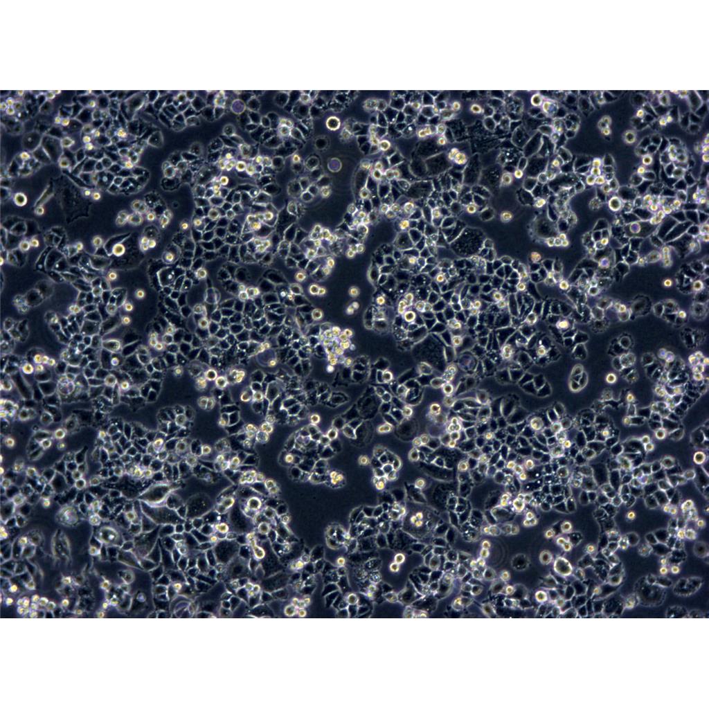 KYSE410 Cells#人食管鳞癌细胞系传代性好|培养基|有STR图谱