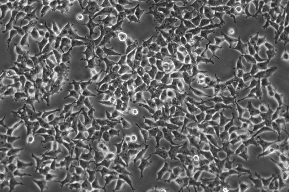 MeT 5A Cells#人膜间皮细胞系传代性好|培养基|有STR图谱