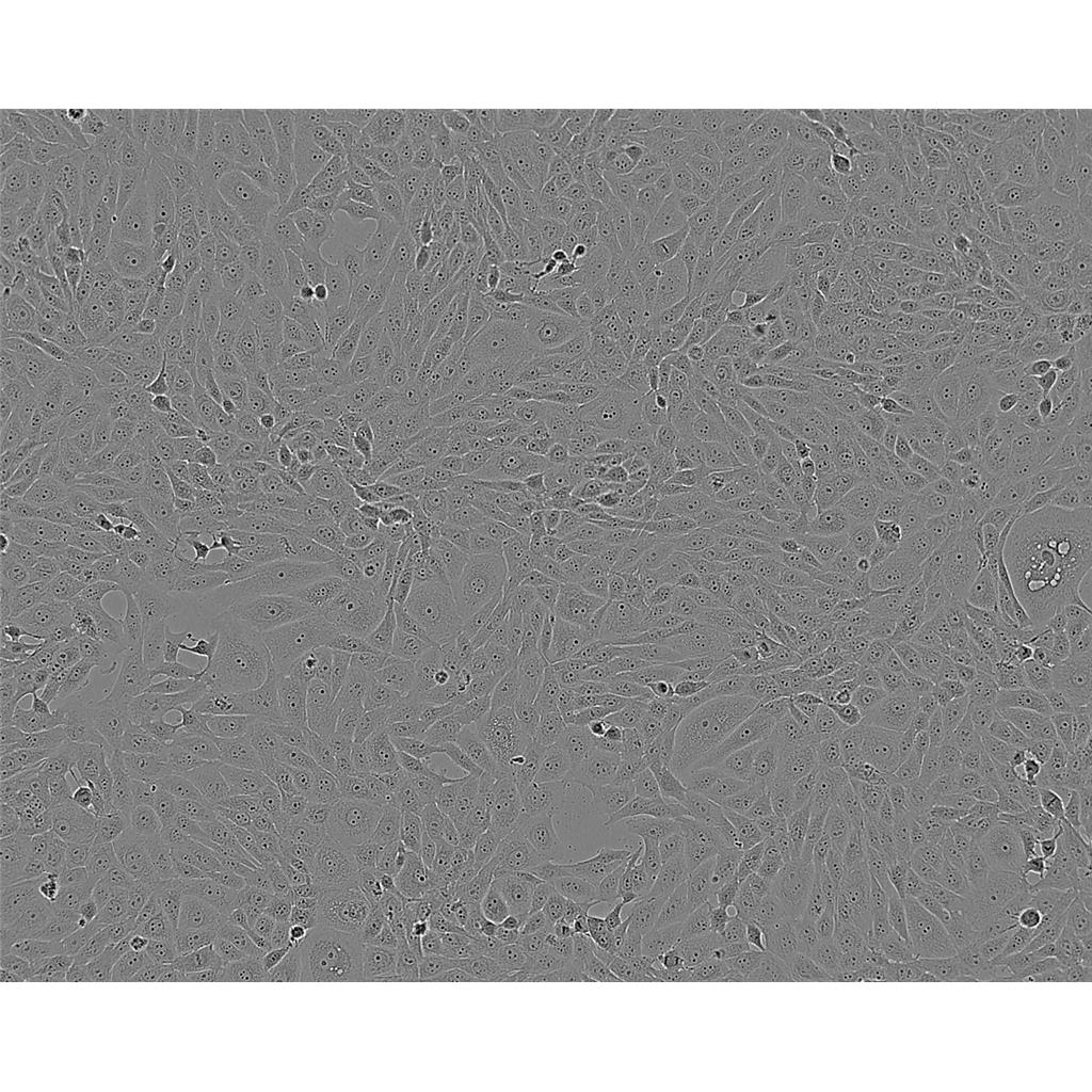 HTh-7 Cells#人甲状腺癌细胞系传代性好|培养基|有STR图谱