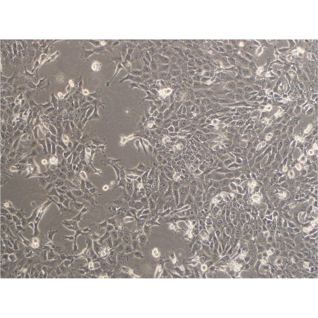 SW620 Cells#人结肠癌细胞系传代性好|培养基|有STR图谱