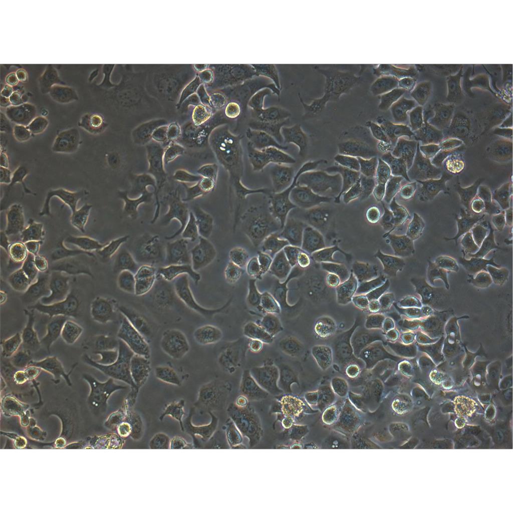 SKMEL1 Cells#人皮肤黑色素瘤细胞系复苏中心|完全培养基|STR图谱