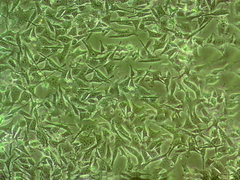 NCI-H1975人肺腺癌细胞实验室|已有STR图谱