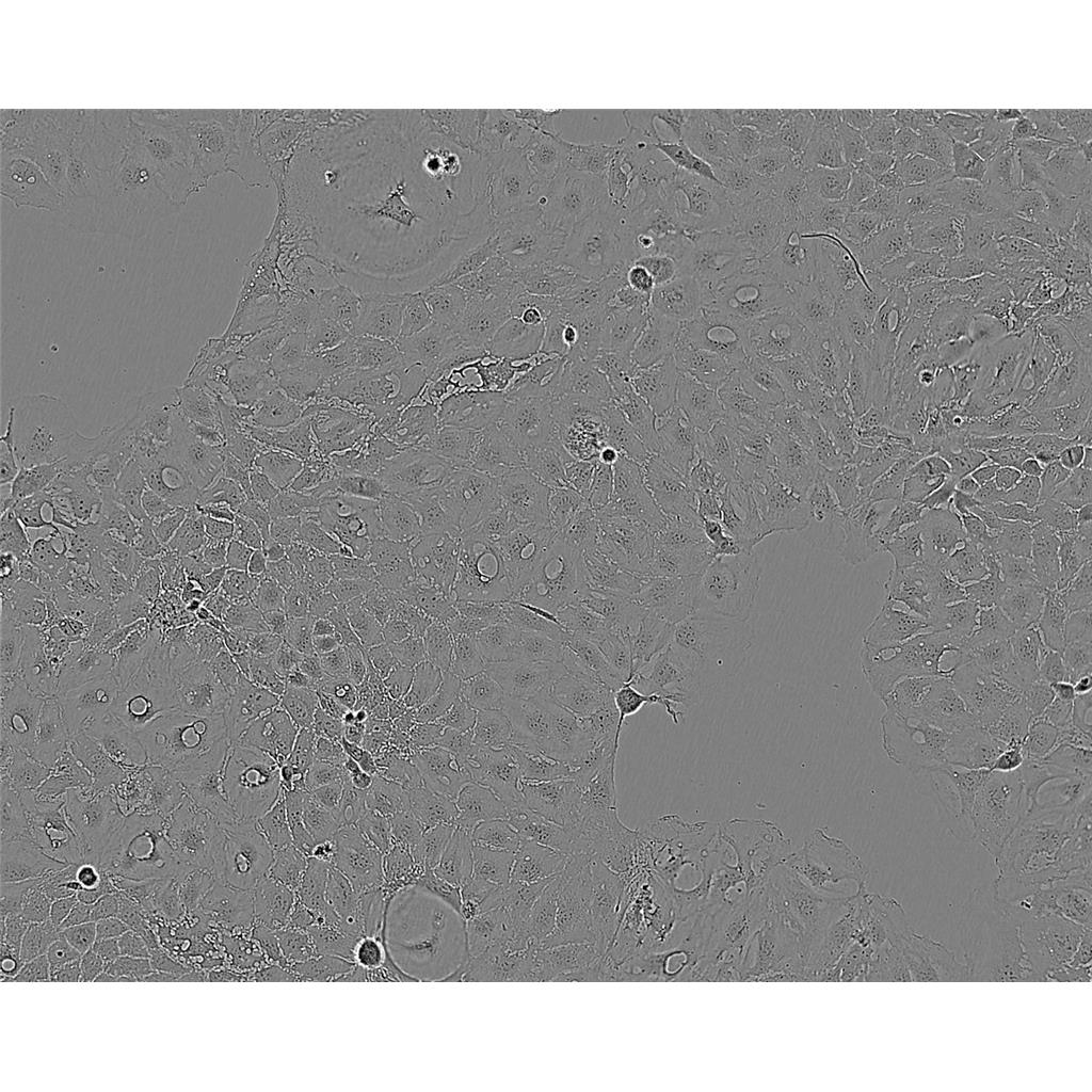 MDA-MB-468人乳腺癌细胞实验室|已有STR图谱