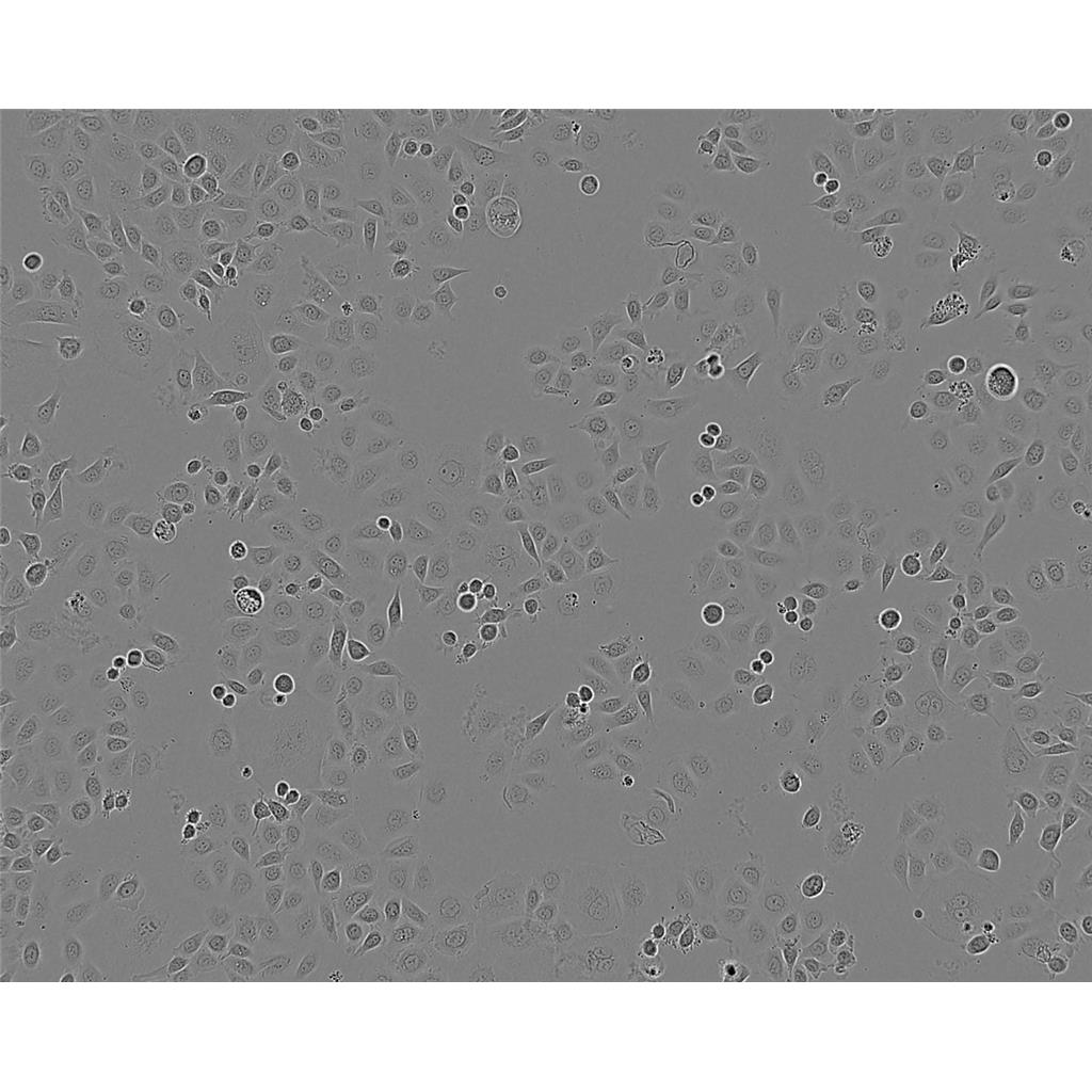 UM-UC-3人膀胱移行癌细胞实验室|已有STR图谱