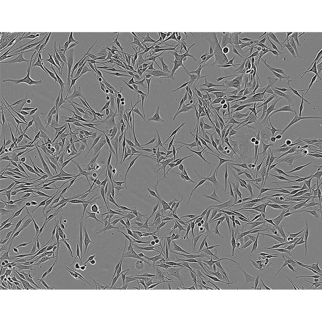 NCIH1703 Cells#人肺腺鳞癌细胞系复苏中心|完全培养基|STR图谱