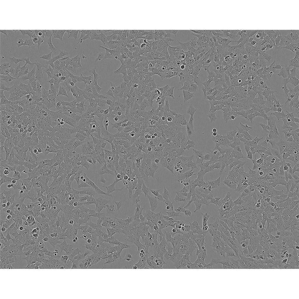 NRK clone 52E Cells#正常大鼠肾细胞系复苏中心|完全培养基|STR图谱