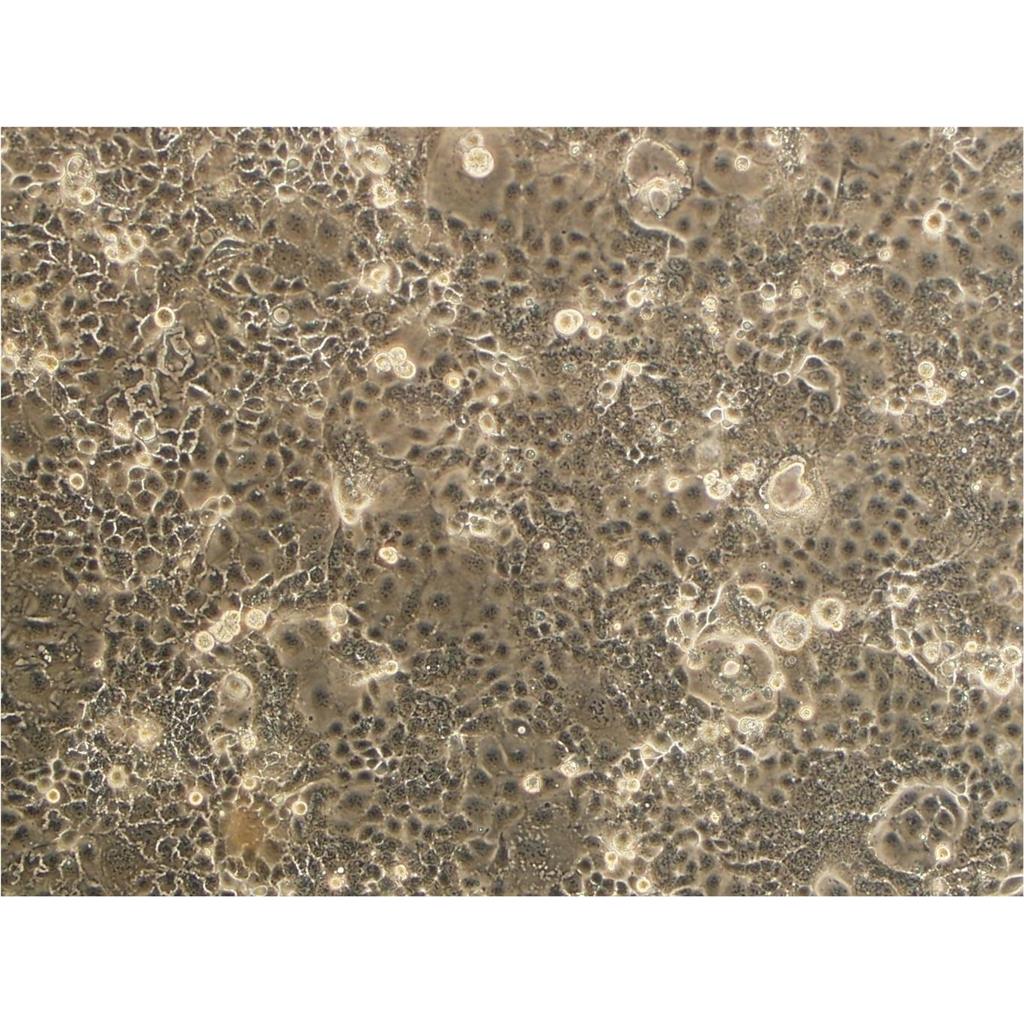 N-87 Cells#人胃癌细胞系复苏中心|完全培养基|STR图谱