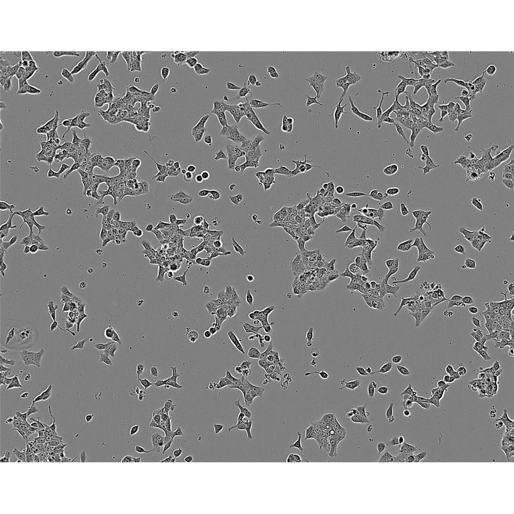 mda-MB453 Cells#人乳腺癌细胞系复苏中心|完全培养基|STR图谱